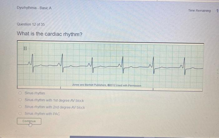 Dysrhythmia Basic A Time Remaining 10 Question 12 Of 35 What Is The Cardiac Rhythm Ii N N Jordate Publishers 2012 Uue 1