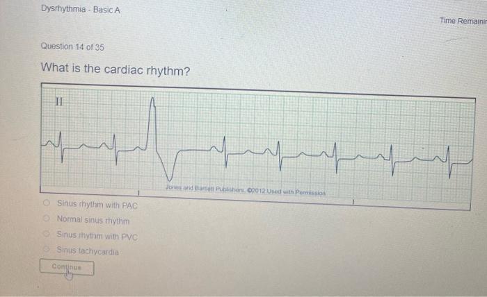 Dysrhythmia Basic A Time Remaining 10 Question 12 Of 35 What Is The Cardiac Rhythm Ii N N Jordate Publishers 2012 Uue 2