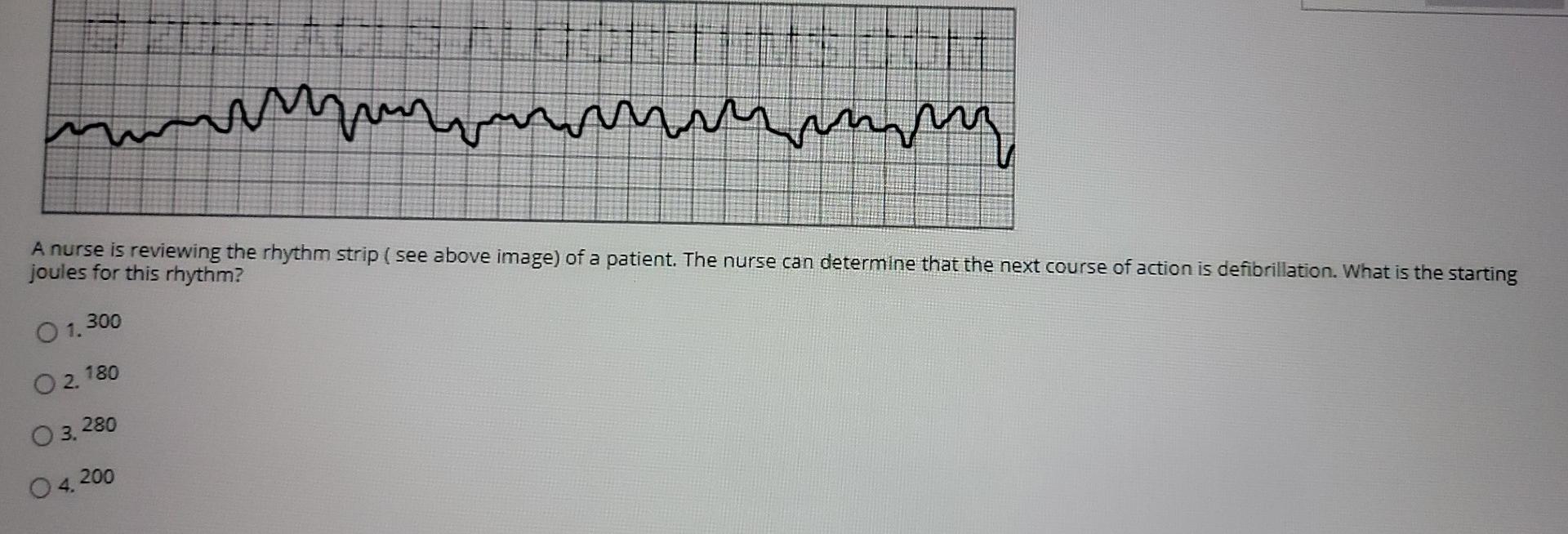 Ummmmmmm A Nurse Is Reviewing The Rhythm Strip See Above Image Of A Patient The Nurse Can Determine That The Next Co 1