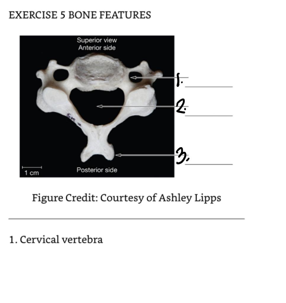 Exercise 5 Bone Features This Exercise Is To Help You Begin To Understand The Terminology We Use To Identify The General 1