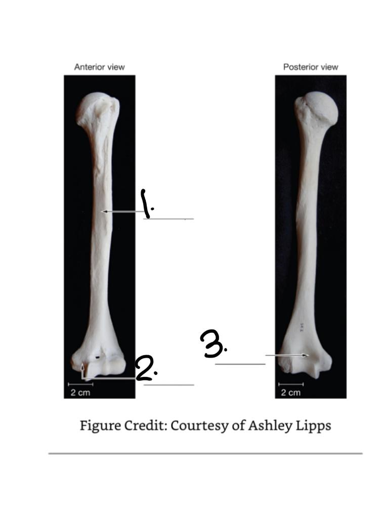 Exercise 5 Bone Features This Exercise Is To Help You Begin To Understand The Terminology We Use To Identify The General 1