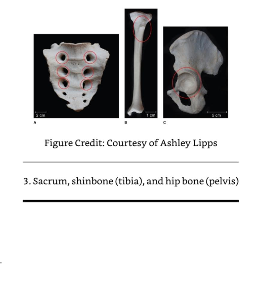 Exercise 5 Bone Features This Exercise Is To Help You Begin To Understand The Terminology We Use To Identify The General 1