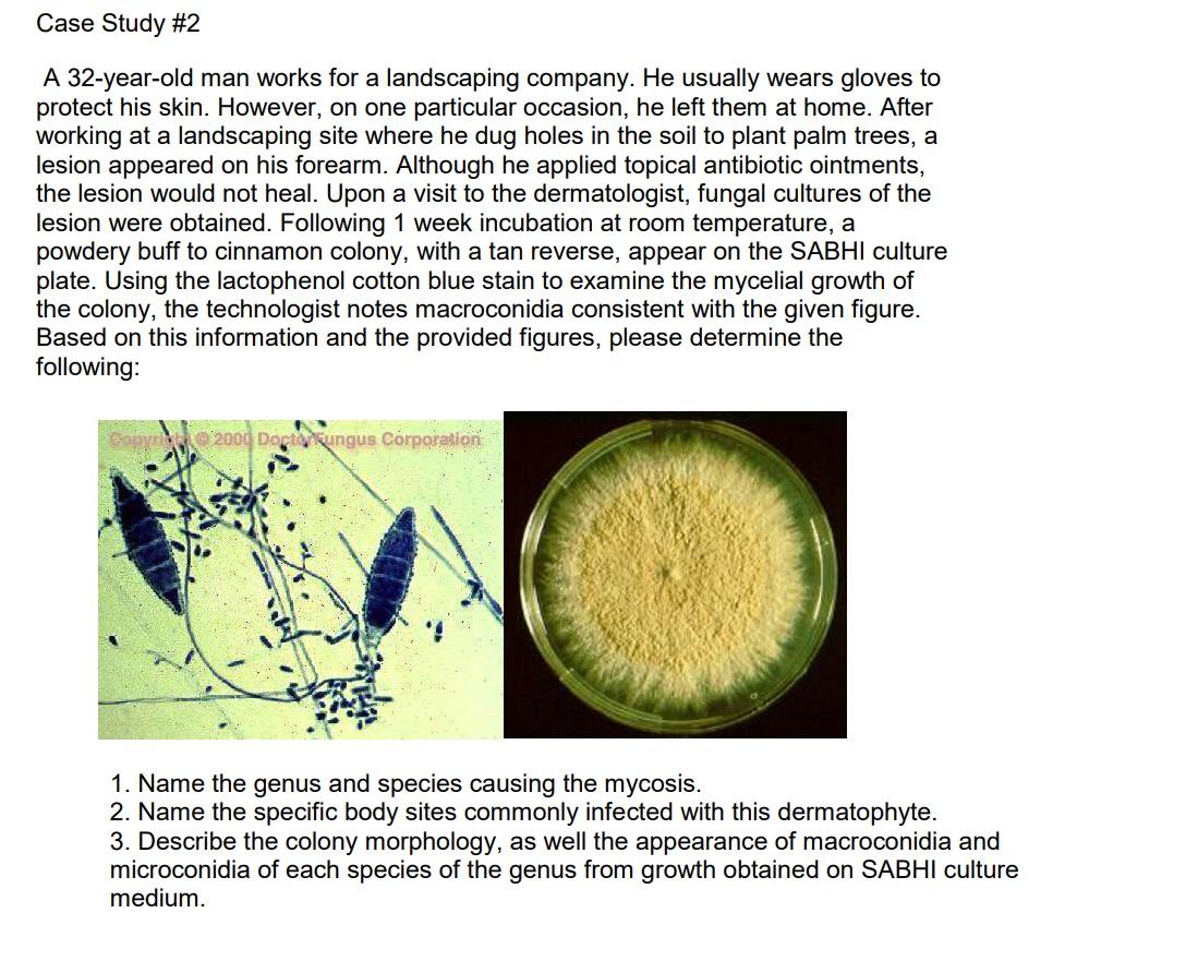 Case Study 2 A 32 Year Old Man Works For A Landscaping Company He Usually Wears Gloves To Protect His Skin However O 1