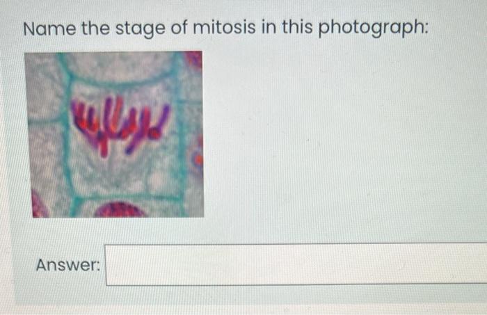 The Zone Of Includes The Root Apical Meristem The Nucleolus Is Visible During Select One A Interphase B Prophase C 5