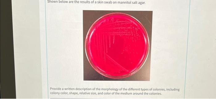 Shown Below Are The Results Of A Skin Swab On Mannitol Salt Agar Provide A Written Description Of The Morphology Of The 1
