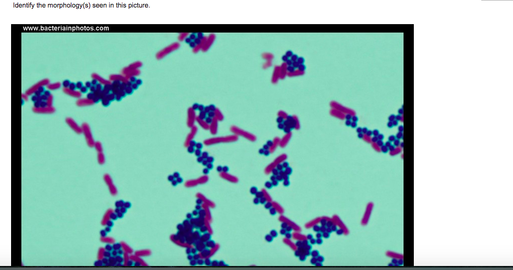 Identify The Morphology S Seen In This Picture Www Bacteriainphotos Com As You Will Note There Are Two Types Of Orga 1