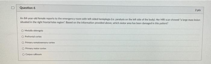 D Question 6 2 Pts An 84 Year Old Female Reports To The Emergency Room With Left Sided Hemiplegia G E Paralysis On The 1