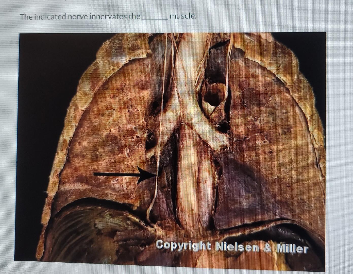 The Indicated Nerve Innervates The Muscle Copyright Nielsen Miller Papercre 1