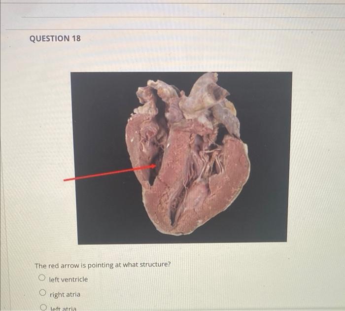 Question 18 The Red Arrow Is Pointing At What Structure O Left Ventricle O Right Atria O Left Atria 1