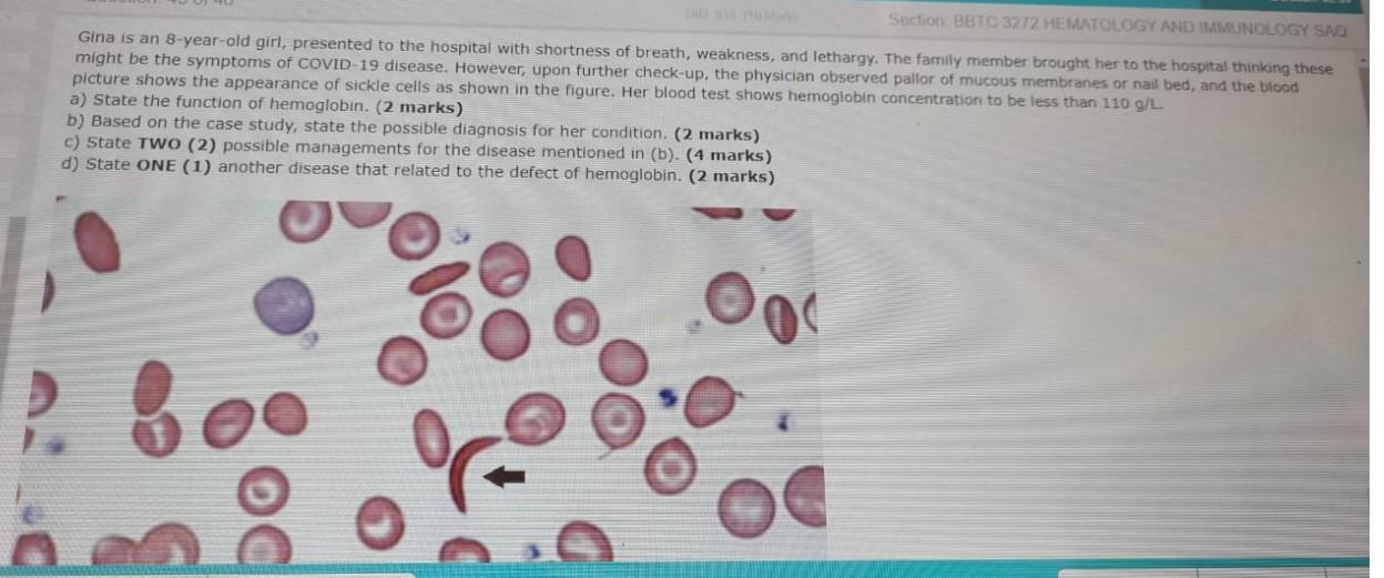 Section Bbtc 3272 Hematology And Immunology Saq Gina Is An 8 Year Old Girl Presented To The Hospital With Shortness Of 1