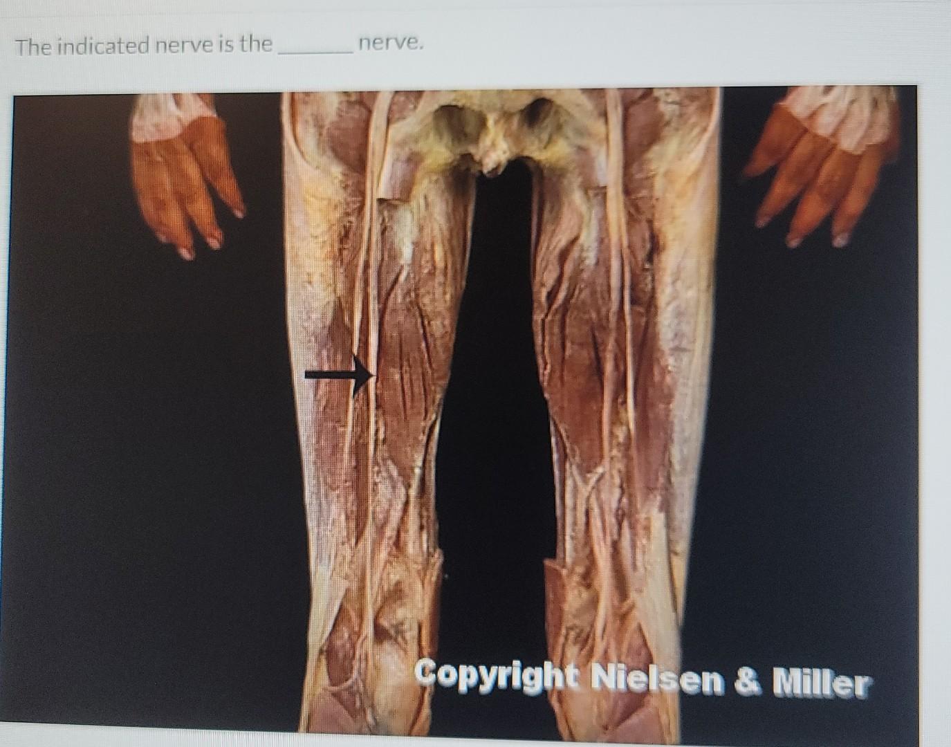 The Indicated Nerve Is The Nerve Copyright Nielsen Miller 1
