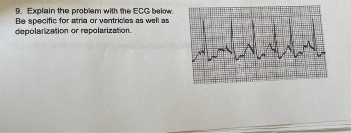 9 Explain The Problem With The Ecg Below Be Specific For Atria Or Ventricles As Well As Or Repolarization Depolarizat 1
