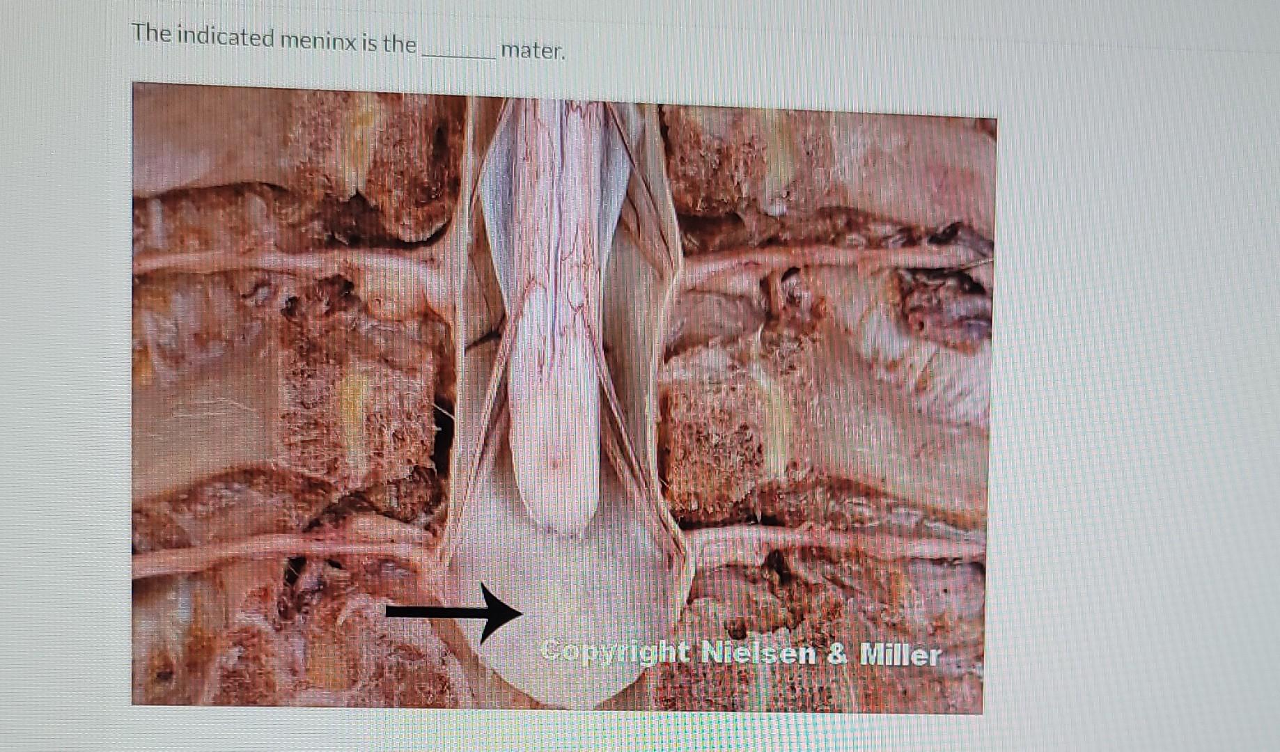 The Indicated Meninx Is The Mater Copyright Nielsen Miller 1