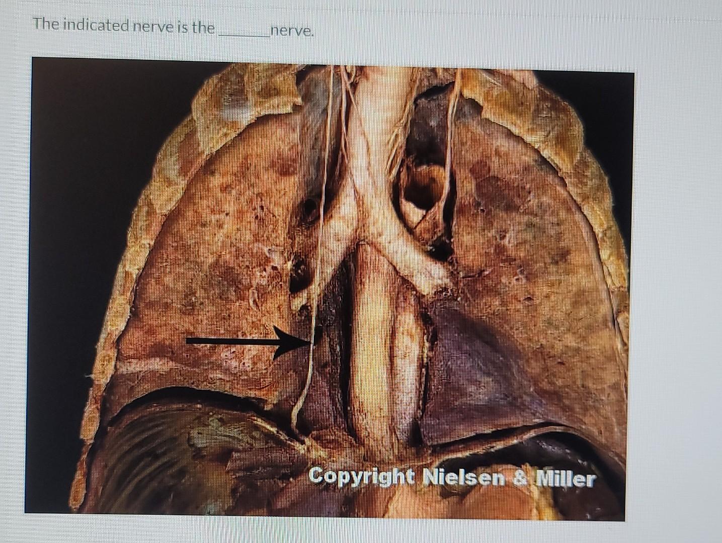 The Indicated Nerve Is The Nerve Copyright Nielsen Miller 1