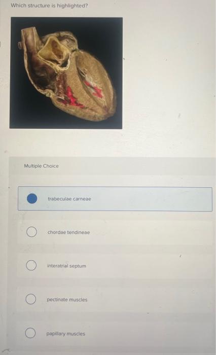 Which Structure Is Highlighted Multiple Choice Trabeculae Carneae Chordae Tendineae Interatrial Septum Pectinate Muscle 1