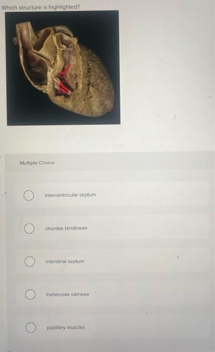 Which Structure Is Highlighted 0 Multiple Choice O O Interventricular Septum Chordae Tendineae Interatrial Septum Trab 1
