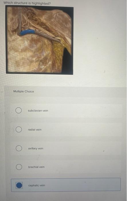 Which Structure Is Highlighted Multiple Choice Tent Subclavian Vein Radial Vein Axillary Vein Brachial Vein Cephalic Ve 1