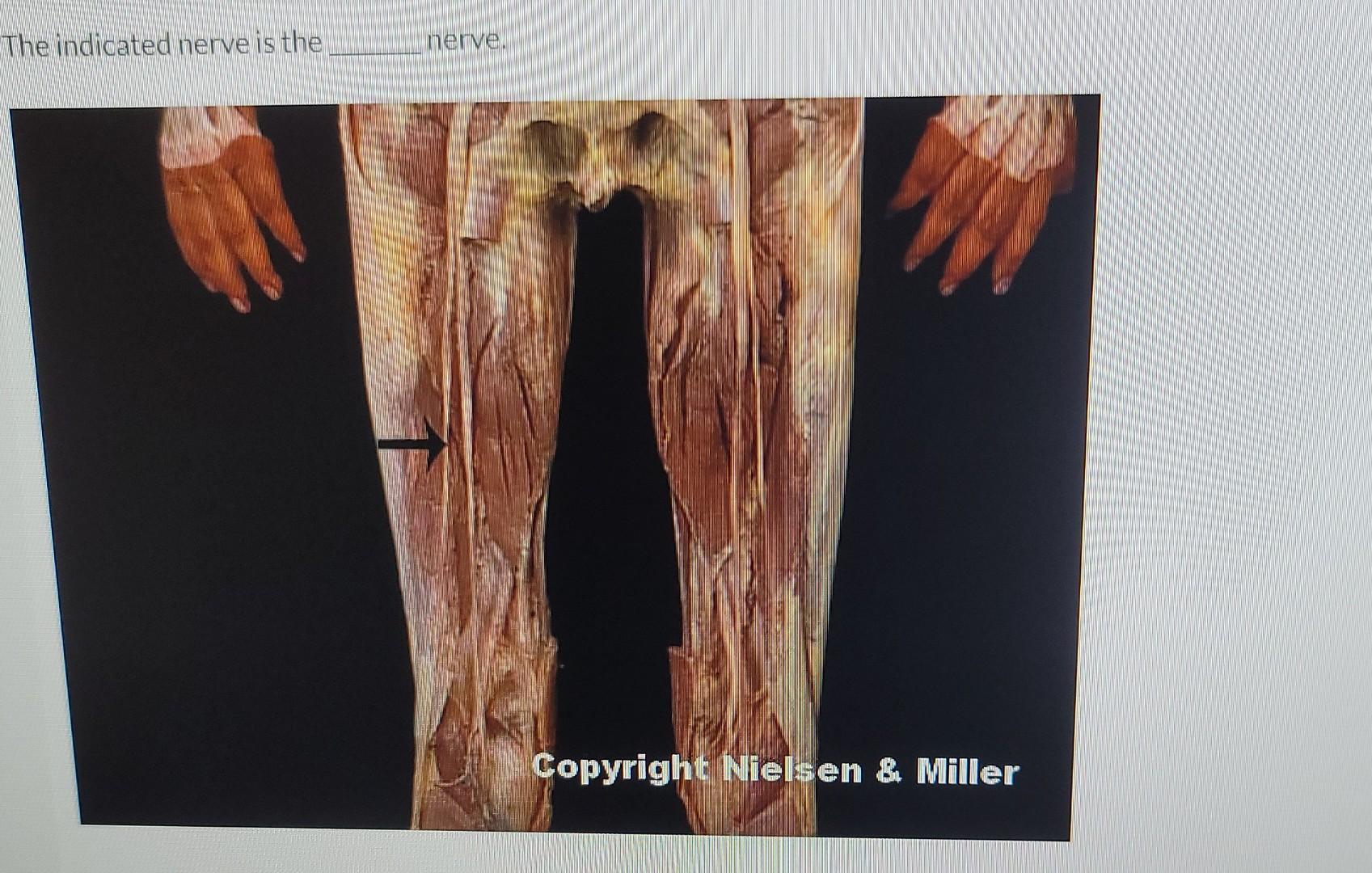 The Indicated Nerve Is The Nerve Copyright Nielsen Miller 1