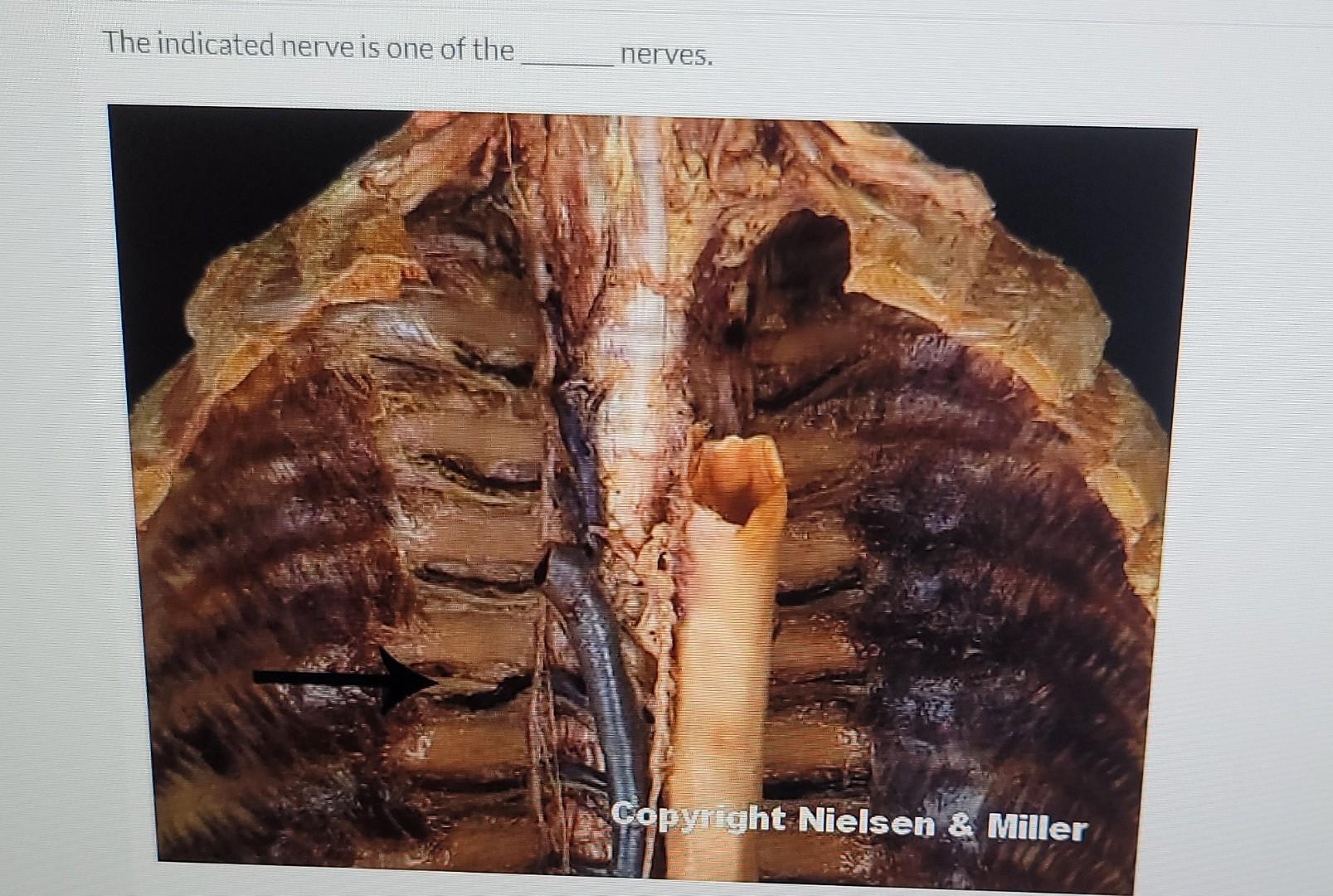 The Indicated Nerve Is One Of The Nerves Copyright Nielsen Miller 1
