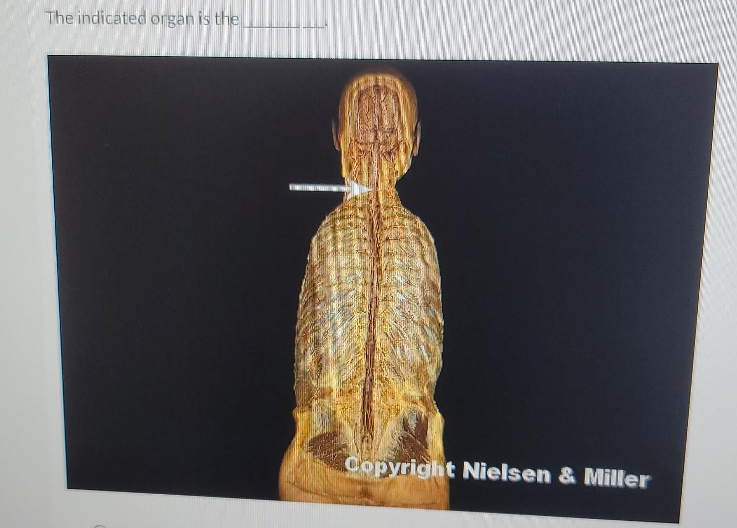 The Indicated Organ Is The Copyright Nielsen Miller 1