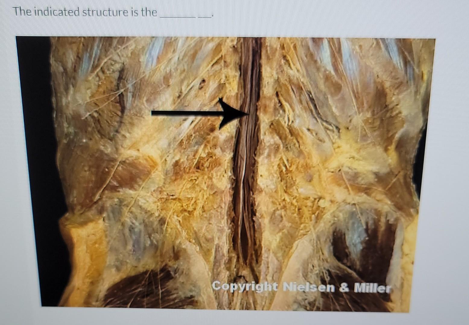 The Indicated Structure Is The Copyright Nielsen Miller 1