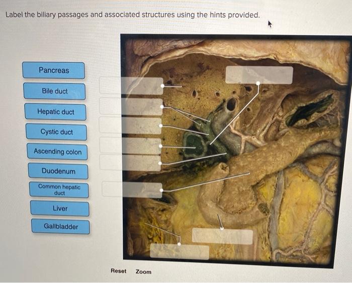Label The Biliary Passages And Associated Structures Using The Hints Provided Pancreas Bile Duct Hepatic Duct Cystic Du 1