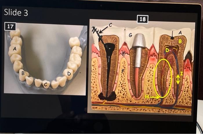 Transverse Abdominal Model Oral Cavity Teeth Stomach Small And Large Intestine Liver Hepatopancreatic Ductal System Panc 3