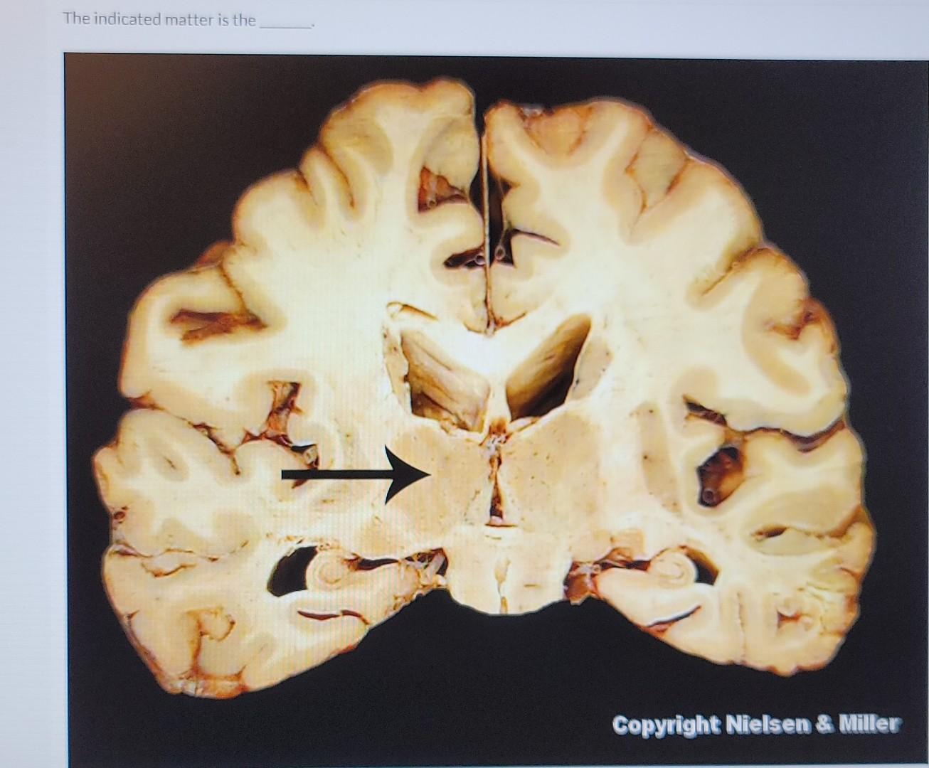 The Indicated Matter Is The Copyright Nielsen Miller 1
