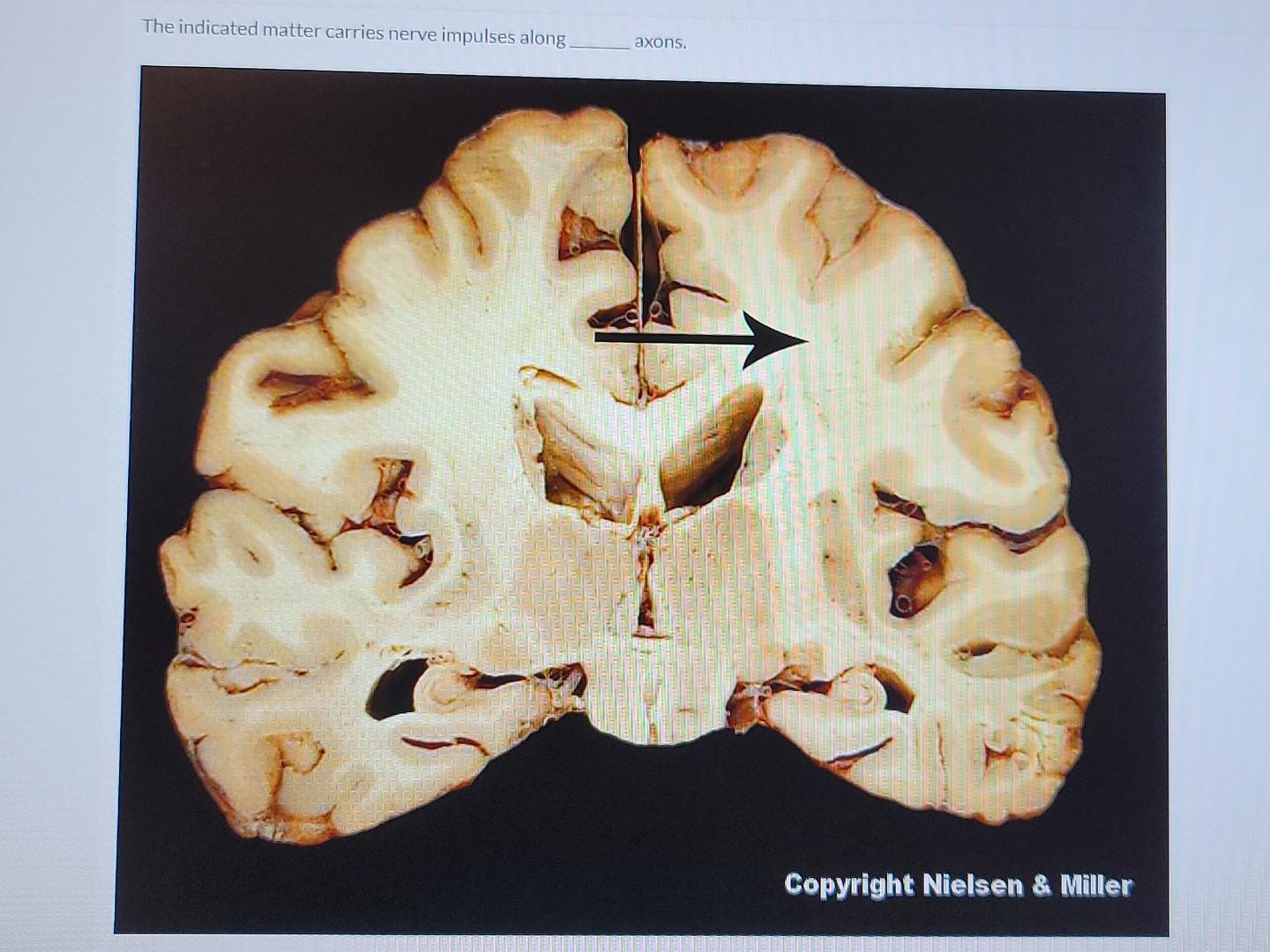 The Indicated Matter Carries Nerve Impulses Along Axons Copyright Nielsen Miller 1