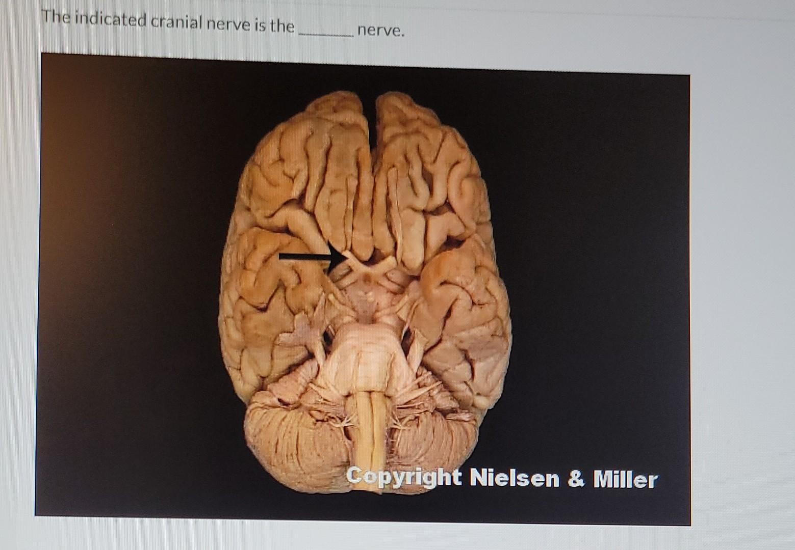 The Indicated Cranial Nerve Is The Nerve Stary Copyright Nielsen Miller 1