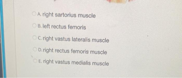 Identify Structure Labeled Number 10 9 10 A Right Sartorius Muscle Ob Left Rectus Femoris Oc Right Vastus Laterali 2