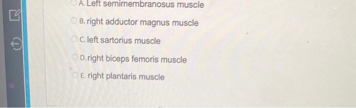 3 Priv Terr A Left Semimembranosus Muscle Ob Right Adductor Magnus Muscle Oc Left Sartorius Muscle Od Right Biceps 2