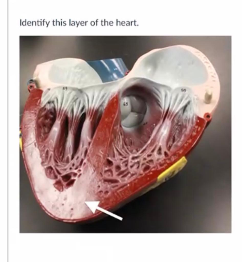 Identify This Layer Of The Heart 1