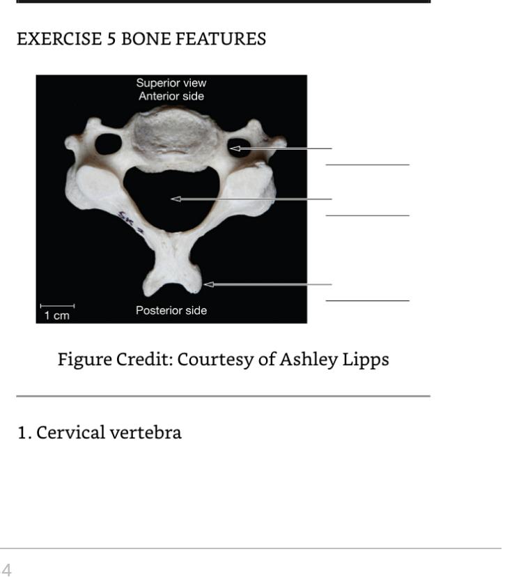 Exercise 5 Bone Features This Exercise Is To Help You Begin To Understand The Terminology We Use To Identify The General 1
