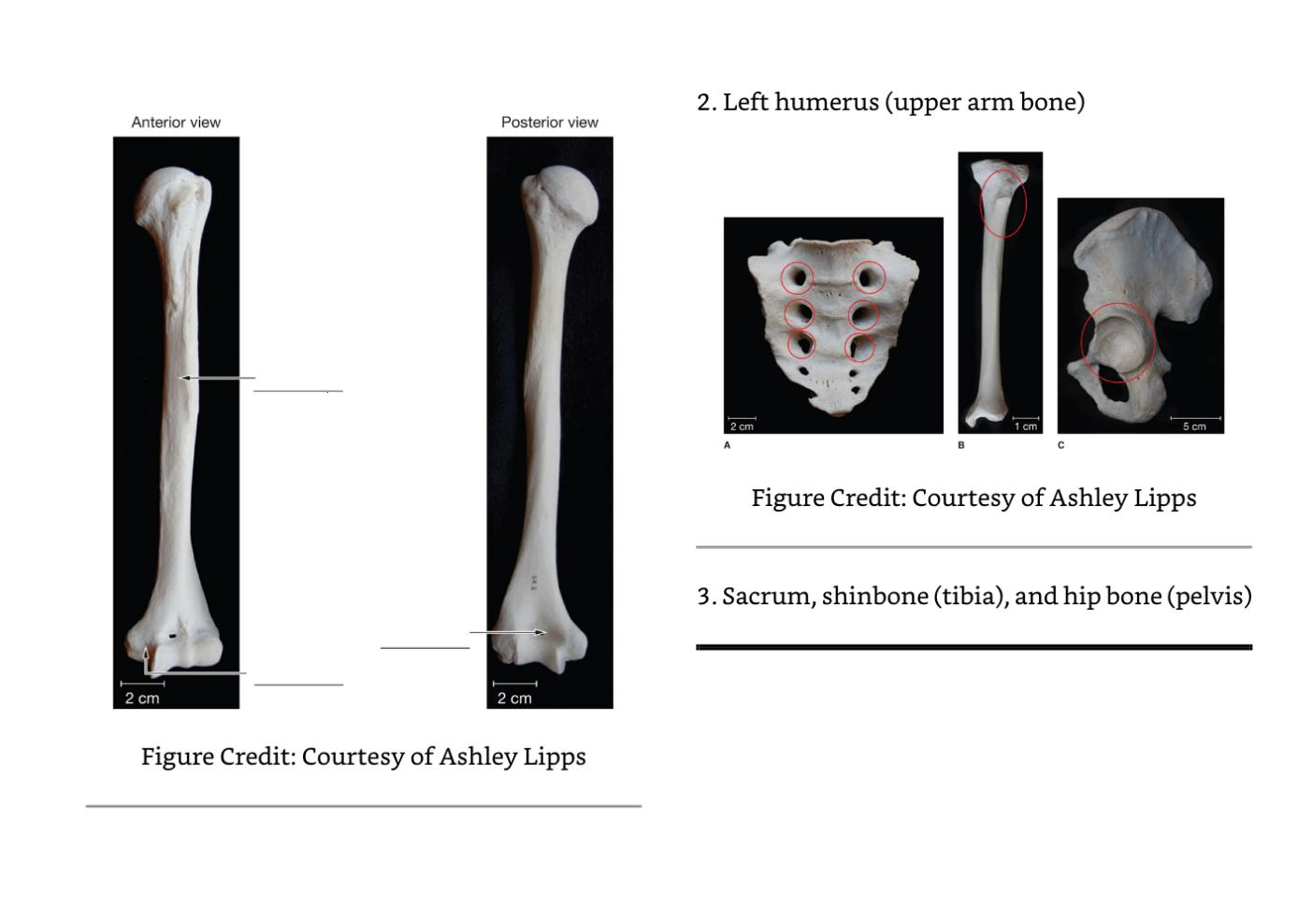 Exercise 5 Bone Features This Exercise Is To Help You Begin To Understand The Terminology We Use To Identify The General 2
