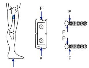 In A Healthy Person When Supporting Their Entire Body On One Leg The Total Weight Of The Human Has A Such An Effect Th 1