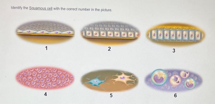 Identify The Squamous Cell With The Correct Number In The Picture 1 4 2 5 3 6 1