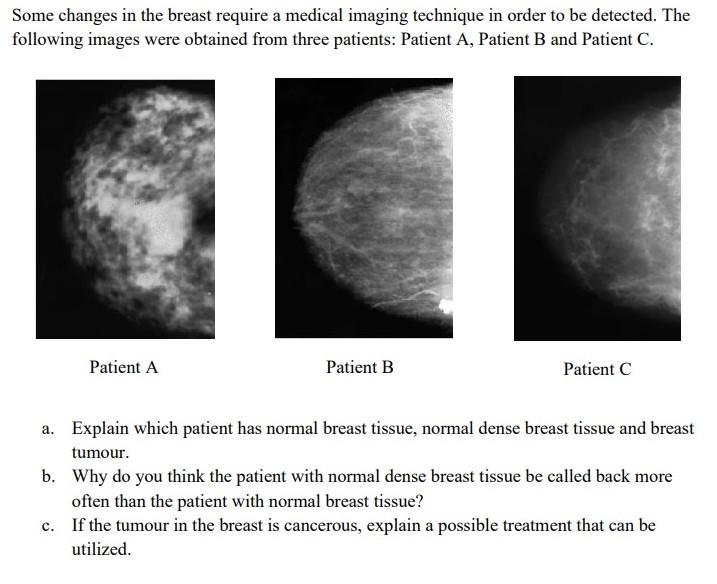 Some Changes In The Breast Require A Medical Imaging Technique In Order To Be Detected The Following Images Were Obtain 1