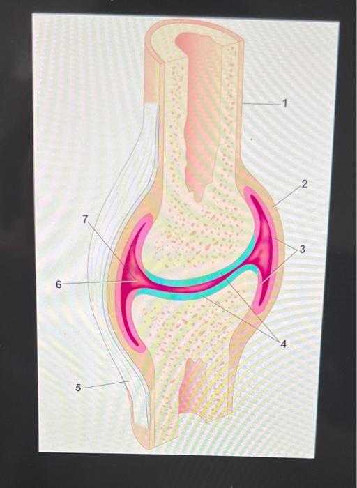 Identify The Ligaments With The Correct Number In The Picture 2 3 2