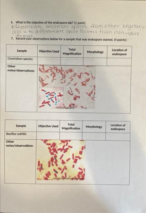 Microbiology Lab Report Acid Fast Staining Endospore Staining 1 What Is The Objective Of The Acid Fast Lab 1 Point 2