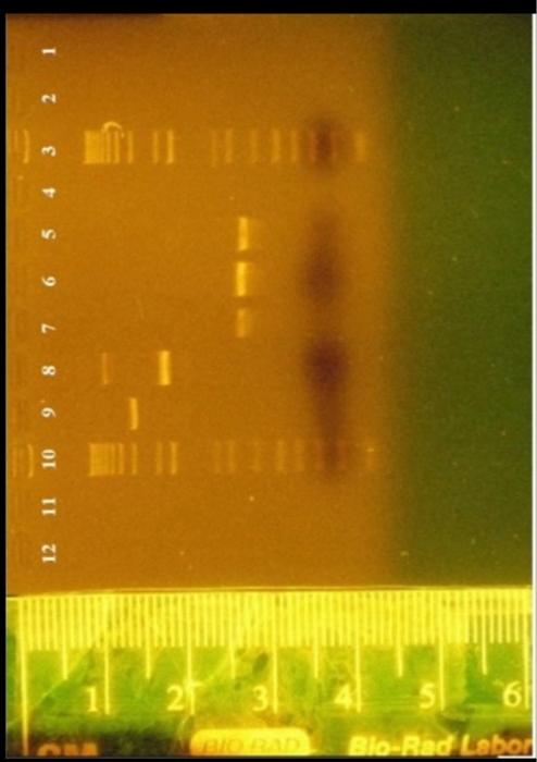 Band 1 Top 2 3 4 5 6 7 8 9 10 11 12 13 14 15 16 17 18 19 20 Lane 3 Or 10 1kb Ladder Distance Traveled Actual Size K 2