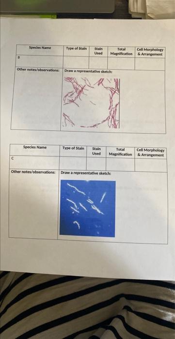 Week 3 Lab Report Simple Stains And Negative Stains 1 What Is The Objective Of These Labs 2 Point Some Morphology 2