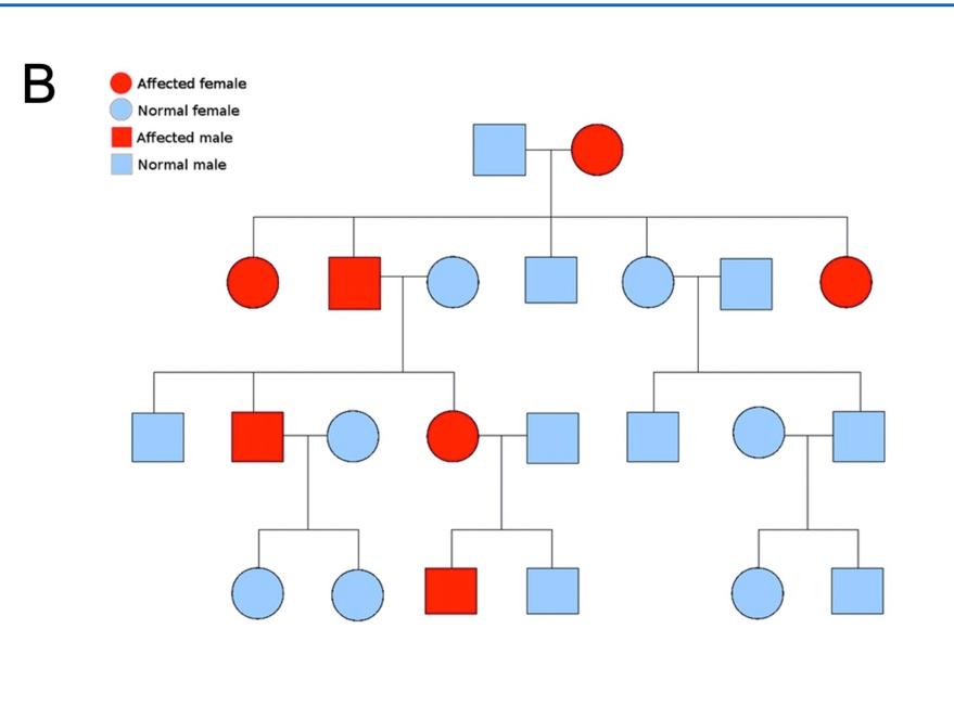 The Dna Of Every Individual In The Pedigree Shown In Image B Below Has Been Sequenced At The Causative Locus All The 1