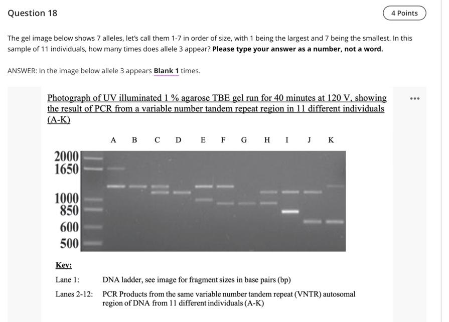 Question 18 The Gel Image Below Shows 7 Alleles Let S Call Them 1 7 In Order Of Size With 1 Being The Largest And 7 Be 1