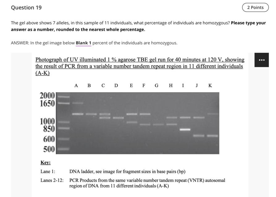 Question 19 The Gel Above Shows 7 Alleles In This Sample Of 11 Individuals What Percentage Of Individuals Are Homozygo 1