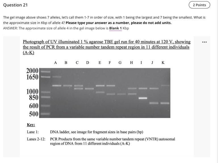Question 21 The Gel Image Above Shows 7 Alleles Let S Call Them 1 7 In Order Of Size With 1 Being The Largest And 7 Be 1