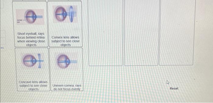22 Pints Ebook Print References Classify Each Of The Following According To The Type Of Vision Abnormality They Describe 2
