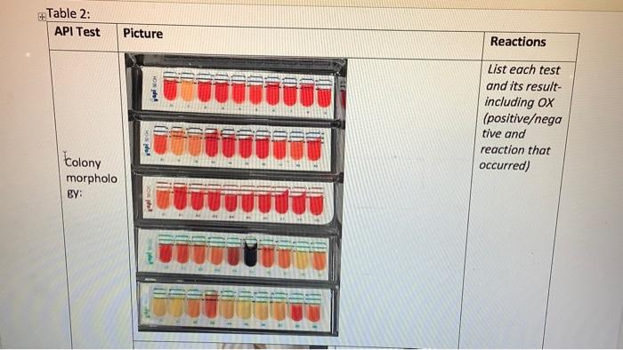Table 2 Api Test Colony Morpholo By Picture Reactions List Each Test And Its Result Including Ox Positive Nega Tive 2