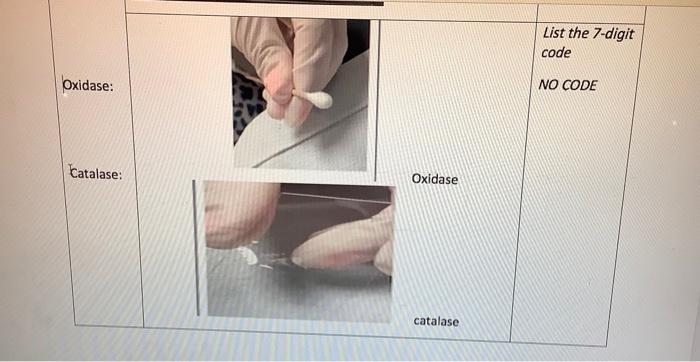 Table 2 Api Test Colony Morpholo By Picture Reactions List Each Test And Its Result Including Ox Positive Nega Tive 3