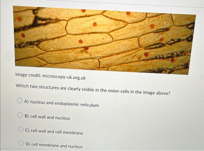 Image Credit Microscopy Uk Org Uk Which Two Structures Are Clearly Visible In The Onion Cells In The Image Above Oa N 1